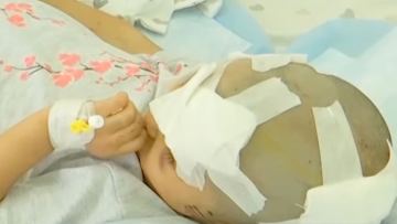 "Бетінің сау тамтығы қалмаған". Түркістан облысында бес жасар қызды ит талап тастаған