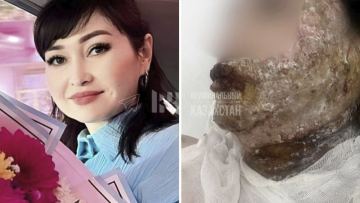 Shymkentte er adam burynǵy áieline qyshqyl shashyp jiberdi