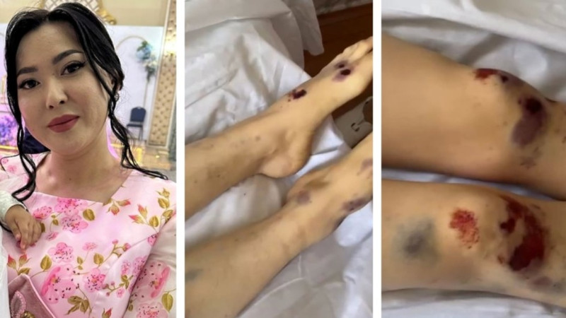 “Attyń jalyna bailap súiregen”. Jambyl oblysynda qaza tapqan áieldiń týystary jaǵdaidyń mán-jaiyn aitty