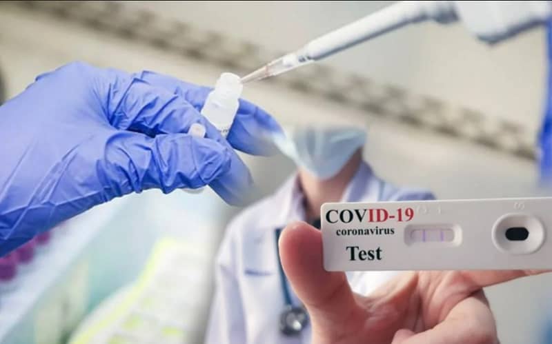 Túrkistan oblysynda 35 myńǵa jýyq PTR test jasalǵan