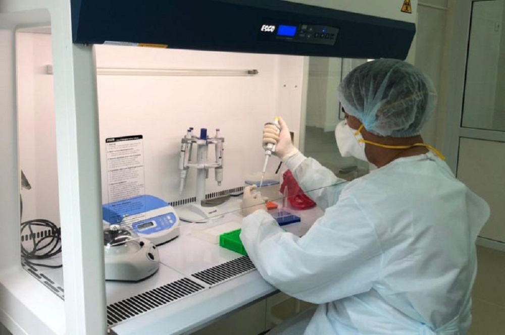 Almaty oblysynda «Covid-19» infektsiiasyn anyqtaityn zerthana ashylady