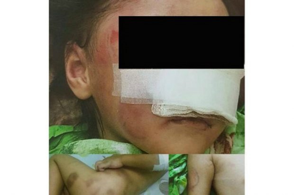 3 жасар қыздың денесін тістеп, мұрнын жұлып алған өгей әкеге үкім шықты