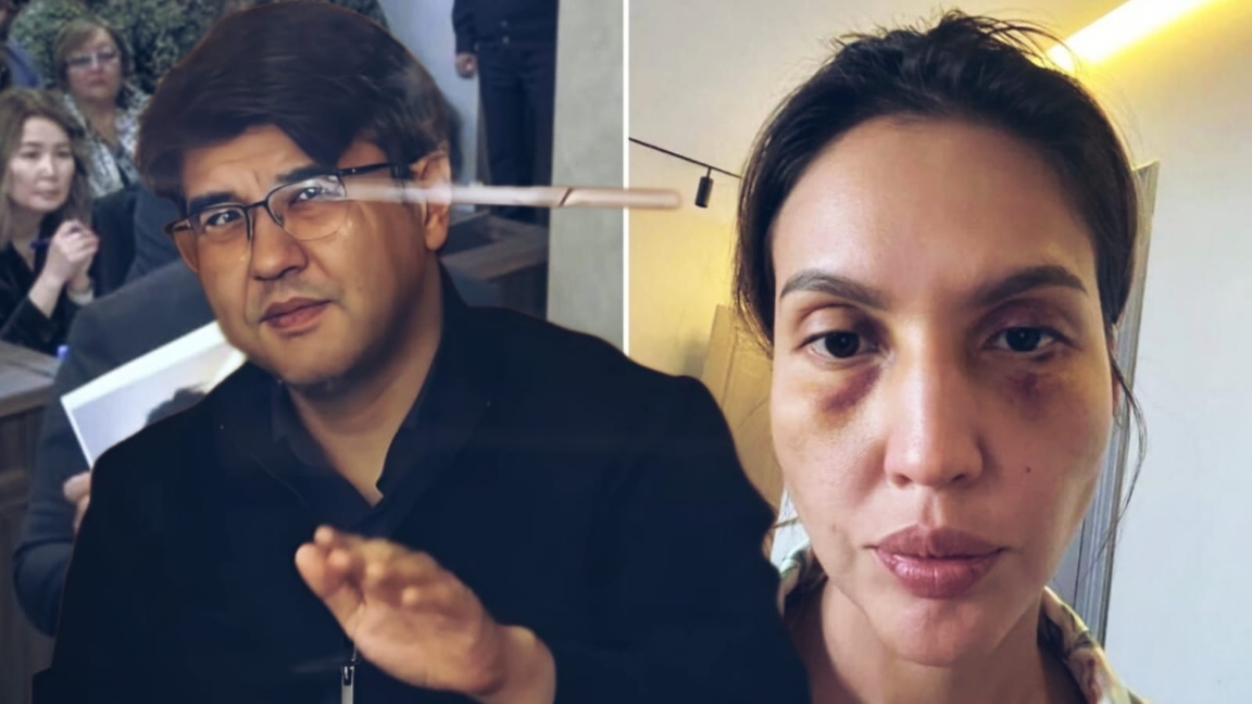 بيشٸمباەۆ نٷكەنوۆانىڭ ٶلٸمٸ تۋرالى: "قابىرعاعا سوعىلىپ, ۋنيتازعا قۇلادى"