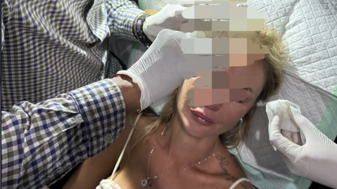 Балидегі бетжыртыс: ресейлік блогер қазақстандық модельдің шабуылына ұшырадым деп айыптады