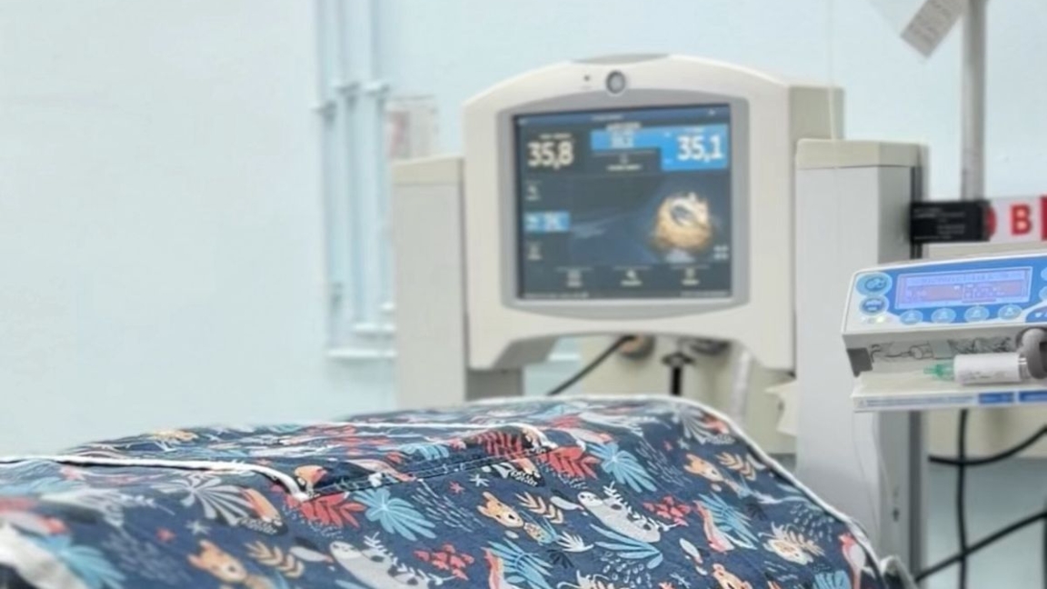 Almatyda dárigerler salmaǵy 730 gramm bolyp týǵan sábidiń ómirin saqtap qaldy