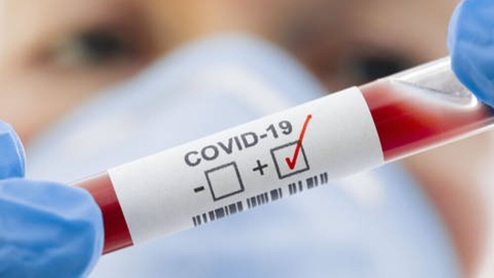 Алматы облысында COVID-19 инфекциясын жұқтырған тағы 3 адам анықталды