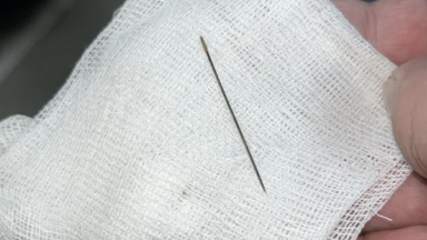 Жағаұстатар жағдай: Түркістанда 8 айлық баланың іш қуысынан ине шықты