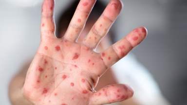 Астанада қызылшаға байланысты қатаң шектеу енгізілді