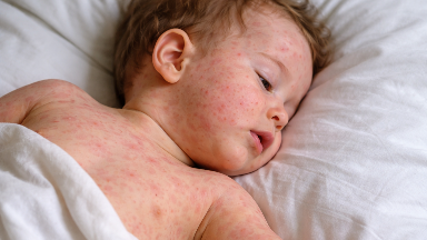 Енді сәбилерге 6 айдан бастап екпе салынады